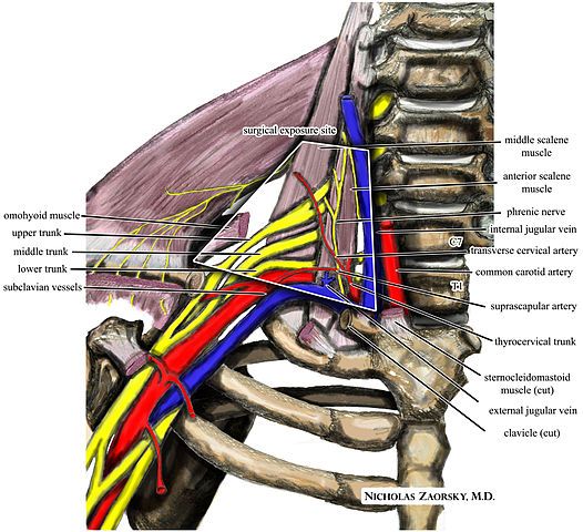 Thoracic Outlet Syndrome - Physio Direct NZ