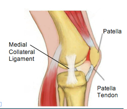 MCL Injuries (Medial Collateral Ligament) - Physio Direct NZ