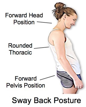 Some Surprising Facts About Posture - Physio Direct NZ