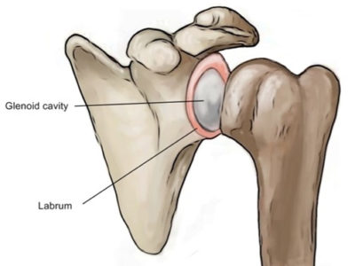Shoulder Labral Tears - Physio Direct NZ