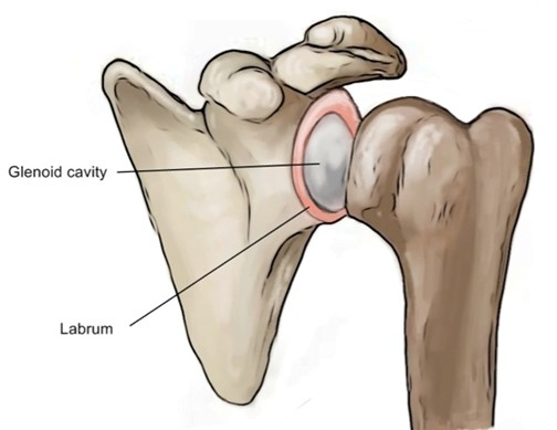 Shoulder Labral Tears - Physio Direct NZ