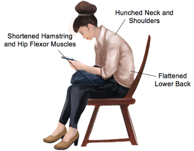 <strong>Focus On Improving Your Posture</strong> - Physio Direct NZ