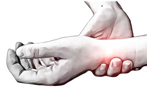 Wrist Sprains - Physio Direct NZ